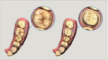 Pre-Operation Scan