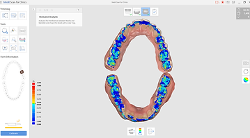Occlusion Analysis
