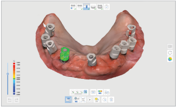 A.I. Scanbody & Abutment Matching