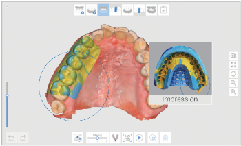 Impression Scanning