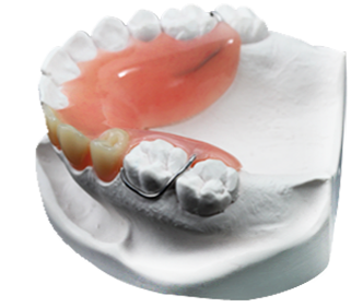 partial denture